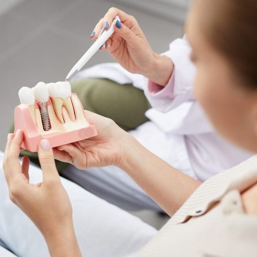 Dental implant model used to explain treatment options