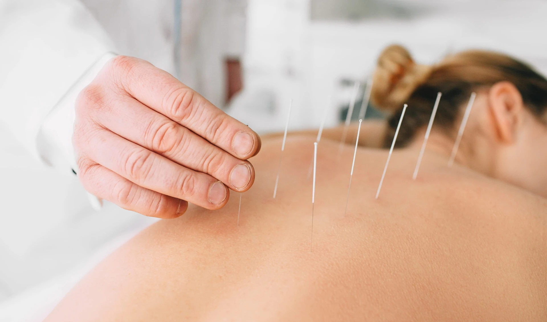 Acupuncturist