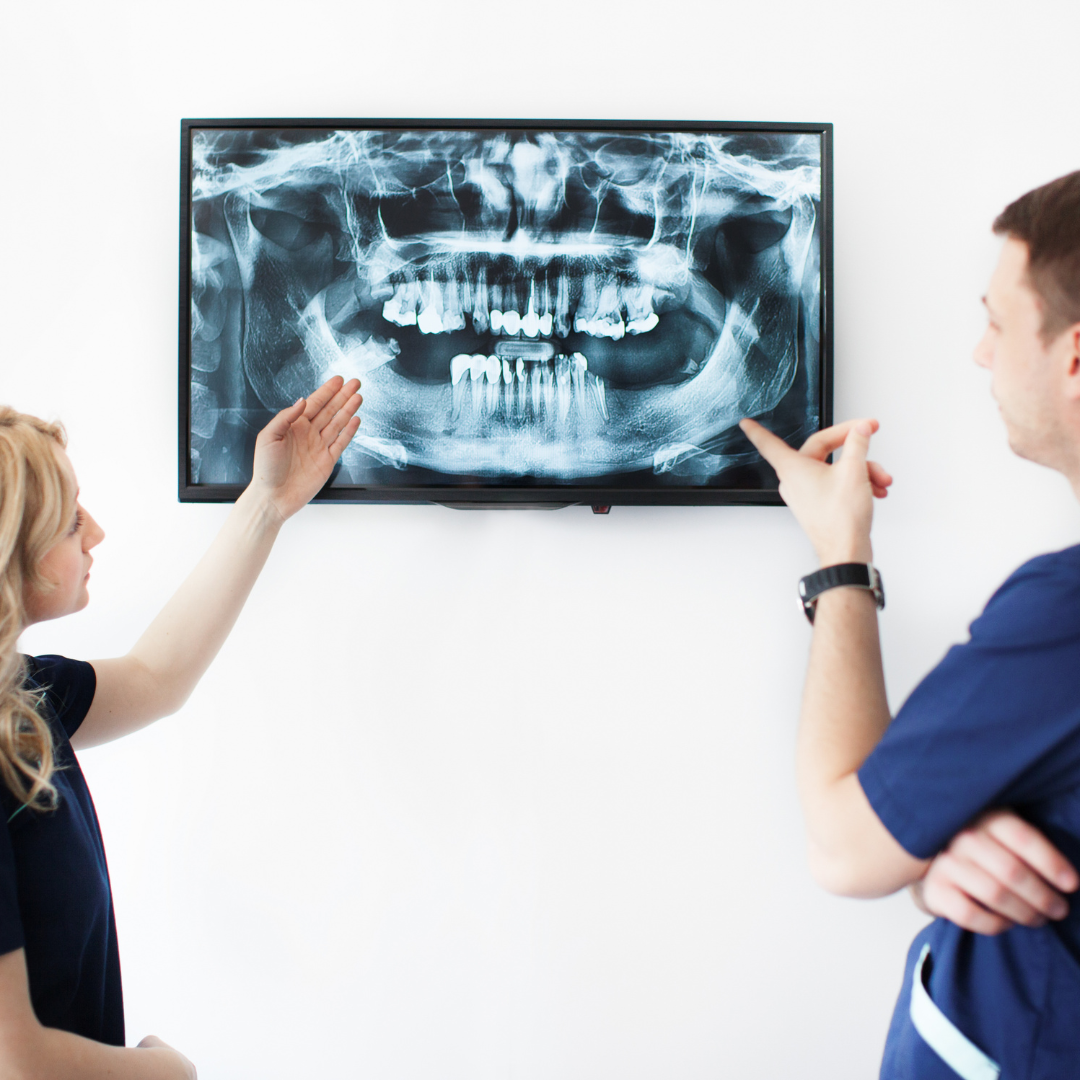 Mouth Cancer Screening